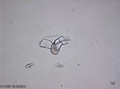 phyto/Brazilian_Nordeste/Northeastcoast_station36/ABRACOS1 October 2015/Histioneis milneri (ancien Histioneis hippoperoides -H. megalocopa-group-St36_280916160928_001_ovl-37)(copy)_thumb.jpg